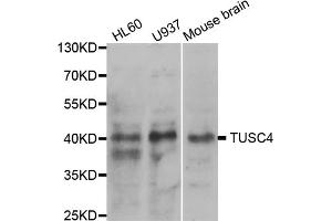 Western blot analysis of extracts of various cell lines, using NPRL2 antibody. (NPRL2 Antikörper)