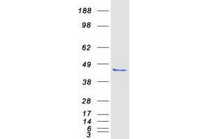 Western Blotting (WB) image for Polymerase (DNA-Directed), delta Interacting Protein 2 (POLDIP2) protein (Myc-DYKDDDDK Tag) (ABIN2729303)