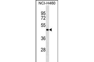 SG Antibody (N-term) (ABIN1539497 and ABIN2849755) western blot analysis in NCI- cell line lysates (35 μg/lane). (SGPP2 Antikörper  (N-Term))