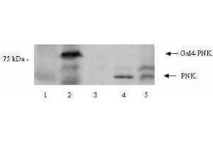 Image no. 1 for anti-Polynucleotide Kinase 3'-Phosphatase (PNKP) (Internal Region) antibody (ABIN401253) (PNKP Antikörper  (Internal Region))