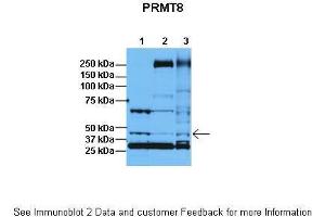 Lanes:   1: 30ug HeLa lysate, 2: 30ug HFF lysate, 3: 30ug U2OS lysate  Primary Antibody Dilution:   1:1000  Secondary Antibody:   Anti-rabbit HRP  Secondary Antibody Dilution:   1:5000  Gene Name:   PRMT8  Submitted by:   Dr. (PRMT8 Antikörper  (C-Term))