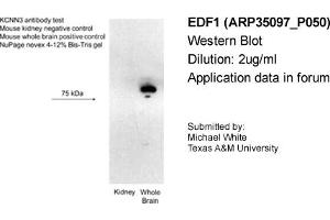 Western Blotting (WB) image for anti-Small Conductance Calcium-Activated Potassium Channel Protein 3 (KCNN3) (C-Term) antibody (ABIN183133) (KCNN3 Antikörper  (C-Term))