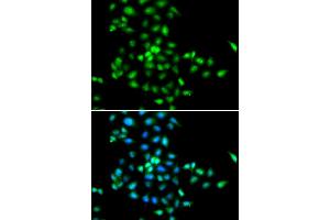 Immunofluorescence analysis of MCF-7 cells using SBDS antibody (ABIN5973483). (SBDS Antikörper)