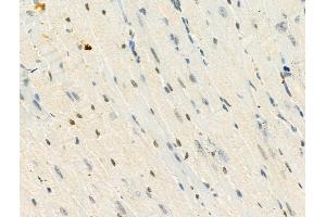 Phospho-MeCP2 (Ser423) Antibody at 1/100 staining Mouse heart tissue by IHC-P. (MECP2 Antikörper  (pSer423))