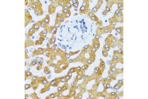 Immunohistochemistry of paraffin-embedded human liver using CCL25 antibody at dilution of 1:100 (40x lens).