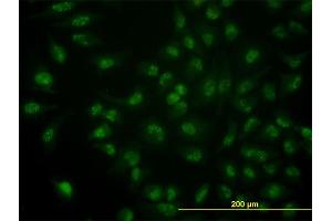 Immunofluorescence of monoclonal antibody to CDC14A on HeLa cell.