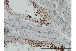 Immunoperoxidase of monoclonal antibody to HMGB2 on formalin-fixed paraffin-embedded human testis. (HMGB2 Antikörper  (AA 1-195))