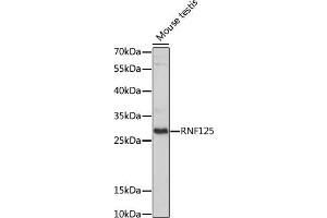 Western blot analysis of extracts of Mouse testis, using RNF125 antibody (ABIN7270057) at 1:1000 dilution. (RNF125 Antikörper  (AA 1-105))