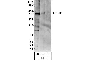 anti-Pleckstrin Homology Domain Interacting Protein (PHIP) (AA 1600-1650) antibody