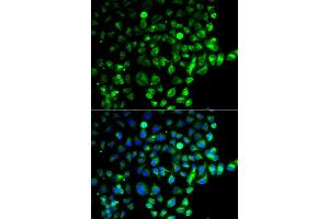 Immunofluorescence analysis of  cells using R antibody (ABIN6128595, ABIN6146569, ABIN6146571 and ABIN6220321). (RAB31 Antikörper  (AA 1-195))