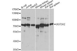 Western blot analysis of extracts of various cell lines, using UGT3A2 antibody. (UGT3A2 Antikörper)