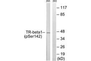 Western blot analysis of extracts from 293 cells treated with PMA 125ng/ml 30', using TR-beta1 (Phospho-Ser142) Antibody. (THRB Antikörper  (pSer142))