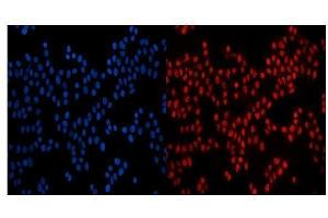 IF analysis of GP210/NUP210 using anti-GP210/NUP210 antibody (ABIN7600707). (NUP210 Antikörper  (AA 221-1724))