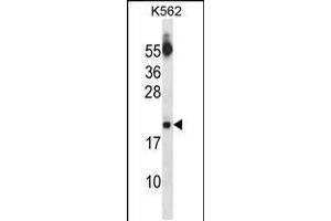 Western blot analysis in K562 cell line lysates (35ug/lane). (SAP18 Antikörper  (AA 58-86))