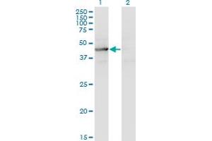 Western Blot analysis of TEX28 expression in transfected 293T cell line by TEX28 monoclonal antibody (M05), clone 1A8. (TEX28 Antikörper  (AA 1-410))