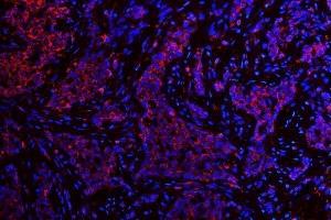 IF analysis of ATG14L using anti-ATG14L antibody (ABIN3043721). (ATG14 Antikörper  (N-Term))