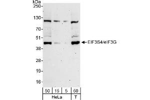 Western Blotting (WB) image for anti-Eukaryotic Translation Initiation Factor 3, Subunit G (EIF3G) (AA 1-50) antibody (ABIN7449220)