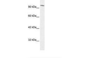 Image no. 1 for anti-SWI/SNF Related, Matrix Associated, Actin Dependent Regulator of Chromatin, Subfamily C, Member 1 (SMARCC1) (AA 828-877) antibody (ABIN203279) (SMARCC1 Antikörper  (AA 828-877))