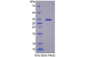SDS-PAGE analysis of Human GBP3 Protein.