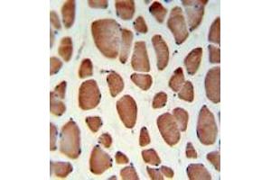 HSD11B2IHC analysis in formalin fixed and paraffin embedded skeletal muscle followed by peroxidase conjugation of the secondary antibody and DAB staining. (HSD11B2 Antikörper  (Middle Region))