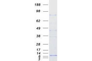 Western Blotting (WB) image for Transducin-Like Enhancer Protein 2 (TLE2) (Transcript Variant 1) protein (Myc-DYKDDDDK Tag) (ABIN2733813)