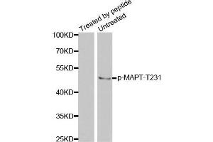 Western Blotting (WB) image for anti-Microtubule-Associated Protein tau (MAPT) (pThr231) antibody (ABIN3020352) (MAPT Antikörper  (pThr231))