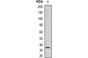 Western blot analysis of NAT1 expression in U937 (A) whole cell lysates. (NAT1 Antikörper)