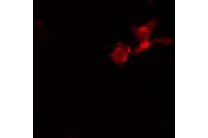 ABIN6274100 staining  HeLa cells by IF/ICC. (PHF1 Antikörper  (Internal Region))