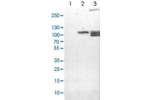 Western blot analysis of Lane 1: NIH-3T3 cell lysate (Mouse embryonic fibroblast cells), Lane 2: NBT-II cell lysate (Rat Wistar bladder tumour cells), Lane 3: PC12 cell lysate (Pheochromocytoma of rat adrenal medulla) with RAP1GAP polyclonal antibody . (RAP1GAP Antikörper)
