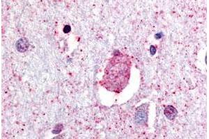 Immunohistochemical (Formalin/PFA-fixed paraffin-embedded sections) staining in human brain, neurons and glia with GPR88 polyclonal antibody .