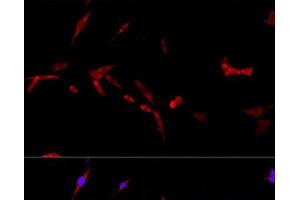 Immunofluorescence analysis of PC-12 cells using CD40L Polyclonal Antibody at dilution of 1:100. (CD40 Ligand Antikörper)