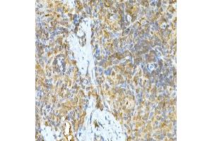 Immunohistochemistry (IHC) image for anti-Tumor Necrosis Factor, alpha-Induced Protein 3 (TNFAIP3) (AA 1-190) antibody (ABIN3022985)