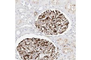 Immunohistochemical staining of human kidney with CDCP2 polyclonal antibody  shows distinct membrane positivity in renal glomeruli. (CDCP2 Antikörper)