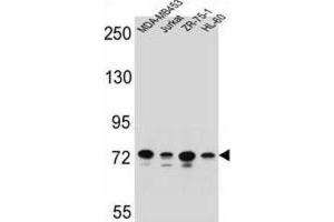 Western Blotting (WB) image for anti-Protocadherin beta 15 (PCDHB15) antibody (ABIN2996491) (PCDHB15 Antikörper)