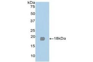 Detection of Recombinant PPARg, Human using Polyclonal Antibody to Peroxisome Proliferator Activated Receptor Gamma (PPARg) (PPARG Antikörper  (AA 349-488))