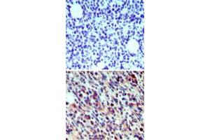 Immunohistochemical analysis of Cd207 in paraffin-embedded formalin-fixed mouse breast tissue using an isotype control (top) and Cd207 polyclonal antibody  (bottom) at 5 ug/mL . (CD207 Antikörper  (AA 36-44))