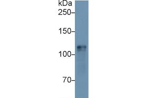 Western Blot; Sample: Mouse Heart lysate; Primary Ab: 1µg/ml Rabbit Anti-Mouse HK1 Antibody Second Ab: 0. (Hexokinase 1 Antikörper  (AA 137-270))