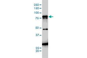 Western Blotting (WB) image for anti-Junction Plakoglobin (JUP) (AA 1-745) antibody (ABIN561572)