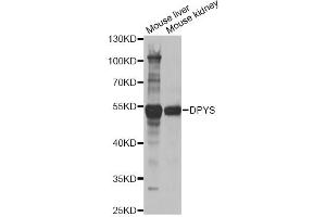 Western blot analysis of extracts of various cell lines, using DPYS antibody (ABIN2562285) at 1:1000 dilution. (DPYS Antikörper)