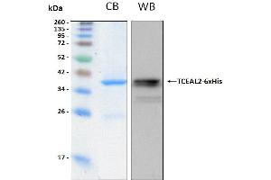 10% SDS-PAGE stained with Coomassie Blue (CB), immunobloting with anti-6xHis monoclonal and peptide fingerprinting by MALDI-TOF mass spectrometry (TCEAL2 Protein (AA 1-227) (His tag))
