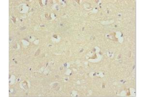 Immunohistochemistry of paraffin-embedded human brain tissue using ABIN7167729 at dilution of 1:100 (RFPL2 Antikörper  (AA 99-378))