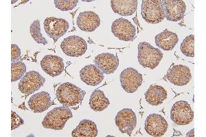 IHC analysis of DAZAP1 using anti-DAZAP1 antibody (ABIN6719309). (DAZAP1 Antikörper  (AA 1-189))