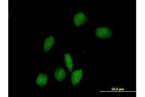 Immunofluorescence of purified MaxPab antibody to ARHGAP9 on HeLa cell.