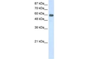 Western Blotting (WB) image for anti-TROVE Domain Family, Member 2 (TROVE2) antibody (ABIN2462169) (TROVE2 Antikörper)
