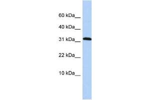 WB Suggested Anti-DYSFIP1 Antibody Titration: 0. (PPP1R27 Antikörper  (Middle Region))