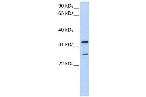 WB Suggested Anti-KCNIP2  Antibody Titration: 0. (KCNIP2 Antikörper  (N-Term))
