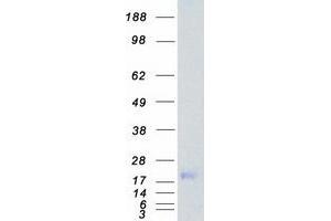 Myosin Light Chain Kinase (MYLK) (Transcript Variant 7) protein (Myc-DYKDDDDK Tag)