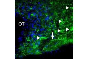 Expression of P2X1 Receptor in rat hypothalamus - Immunohistochemical staining of rat supra-optic nucleus using Anti-P2X1 Receptor Antibody (ABIN7043570, ABIN7045074 and ABIN7045075).