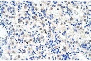 Immunohistochemical staining (Formalin-fixed paraffin-embedded sections) of human liver with DDX47 polyclonal antibody  at 4-8 ug/mL working concentration. (DDX47 Antikörper  (C-Term))
