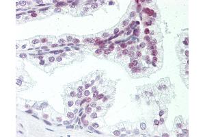 Human Prostate: Formalin-Fixed, Paraffin-Embedded (FFPE). (ZMYM6 Antikörper  (AA 17-66))